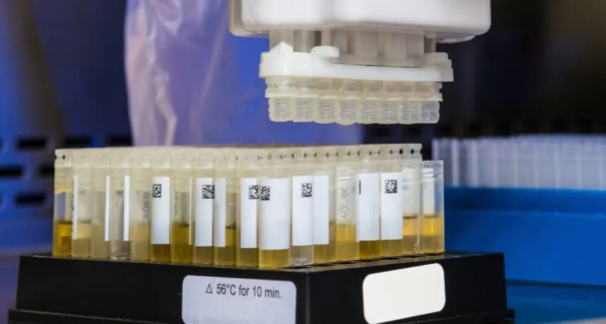 Maskowanie THC w moczu: Metody, ryzyko i czas wykrywalności